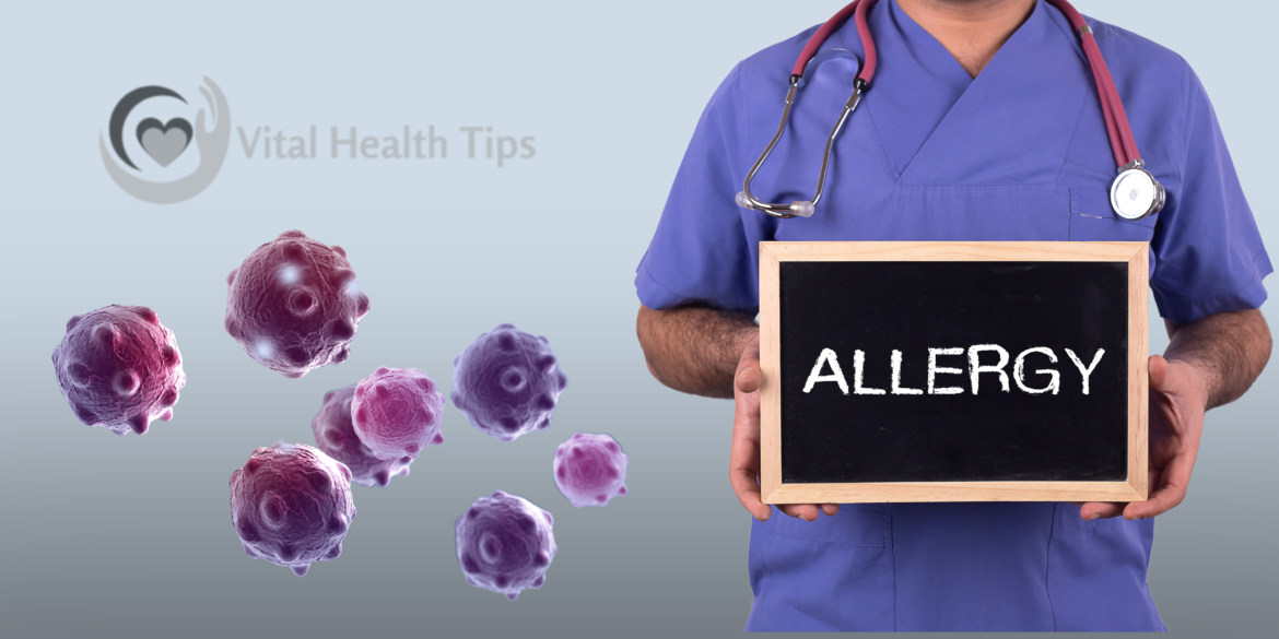 allergies allergies